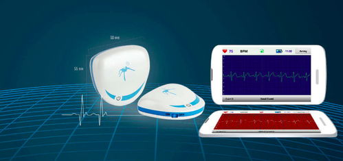 個性化智能心率監測設備研發商獲Pre-A輪融資，加速網絡設備銷售與市場拓展